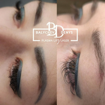 Денис Баличев, Полтава Фото - 1