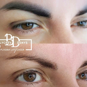 Денис Баличев, Полтава Фото - 2