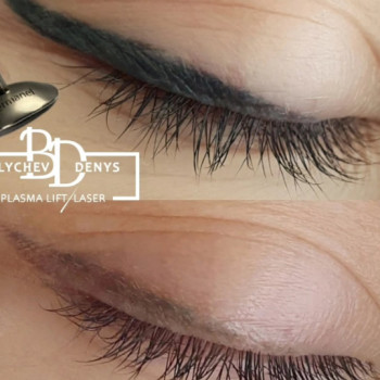 Денис Баличев, Полтава Фото - 4