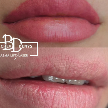 Денис Баличев, Полтава Фото - 5