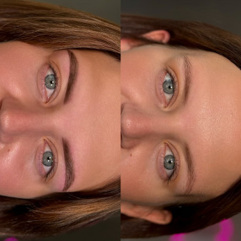 Анна Запорожец, Умань Фото - 3