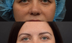  Пластический хирург Ольга Киев