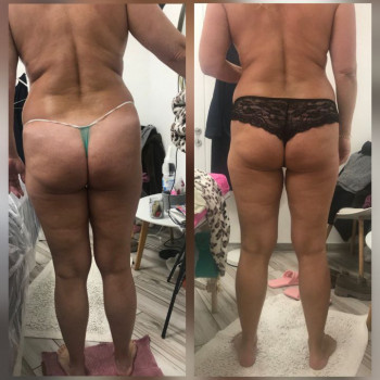 Ольга Сухойван, Днепр Фото - 3