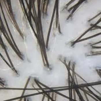 Здорова шкіра