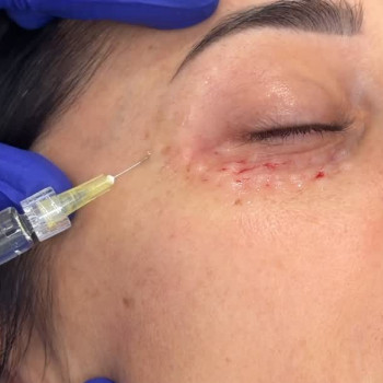 Аделіна Бойко, Кременчук Фото - 5