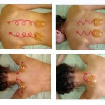 Масаж при хронічному бронхіті
                    Мануальный терапевт Олег Киев