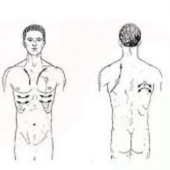 Масаж при хронічному бронхіті
                    Мануальный терапевт Олег Киев