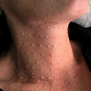 Ольга Сорокопуд, Миколаїв Фото - 22