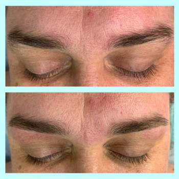 Корекція брів