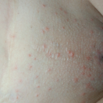 Електроепіляція
                    Майстер депіляції Яна Кам'янське