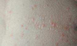 Електроепіляція Майстер депіляції Яна Кам'янське