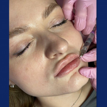 Lazerhall, Ужгород Фото - 6