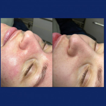 Lazerhall, Ужгород Фото - 7