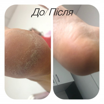 Ірина Абраменко, Кременчуг Фото - 3