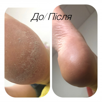 Ірина Абраменко, Кременчуг Фото - 4