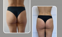  Масажист Ирина Хмельницький