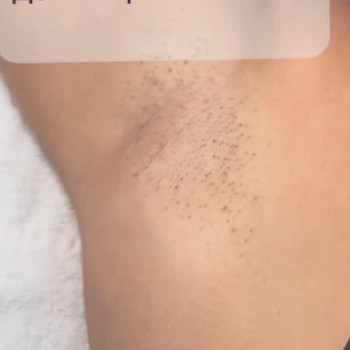 Soft Laser, Кременчуг Фото - 5