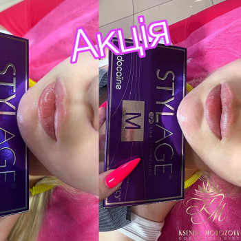 Ксенія Морозова, Житомир Фото - 24