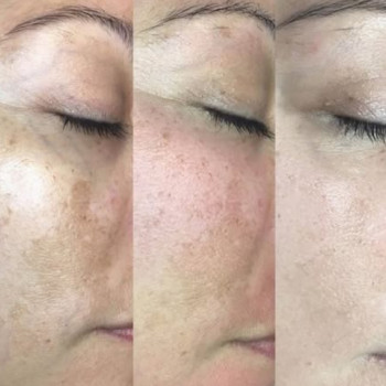 Ірина Переяславець, Лубни Фото - 5