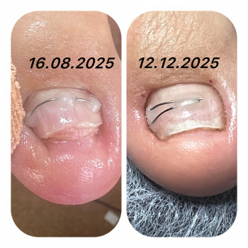 Ірина Абраменко, Кременчуг Фото - 2