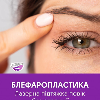 Laser Express, Миргород Фото - 5