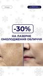 -30% на першу процедуру фотоомолодження 💙 Косметологический центр Lazerhall Ужгород