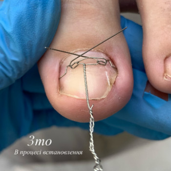 Аліса , Миргород Фото - 5