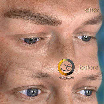  #волосковийтатуажбрів #волосковийперманентбрів #волосковийгіперреалізмбрів #корекціятатуажубрів #корекціяперманентубрів