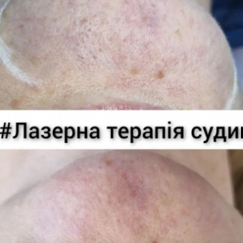 Анастасия Прийтенко, Днепр Фото - 5