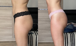 Антицеллюлитный массаж Массажист Елена Одесса