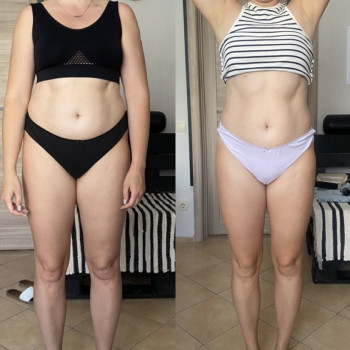 Зроблено 10 сеансів антицелюлітного масажу