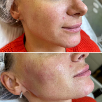 Елена Герастовская, Днепр Фото - 5