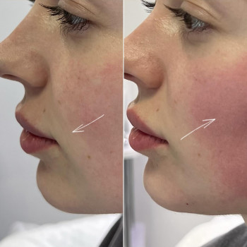 Яна Мороз, Днепр Фото - 5