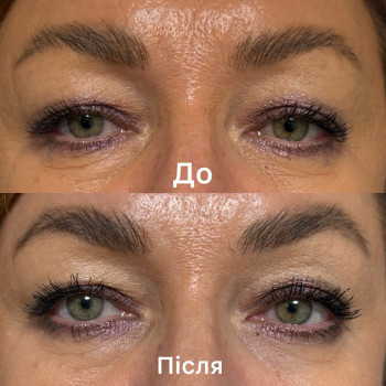 Мікрострумова терапія

9 процедур