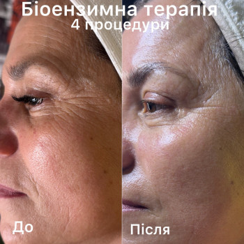 Біоензимна терапія

4 процедури