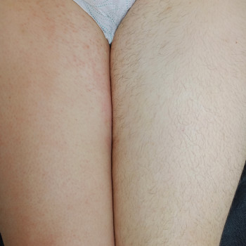 Депіляція воскова
                    Майстер депіляції Наташа Луцьк