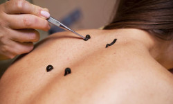 Гирудотерапия Медицинский центр Центр доктора Бубновского Николаев