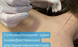 Иголкотерапия Медицинский центр Центр доктора Бубновского Николаев