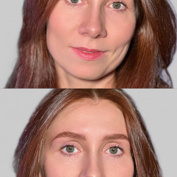 Ліза Яковчук, Вишневе Фото - 6