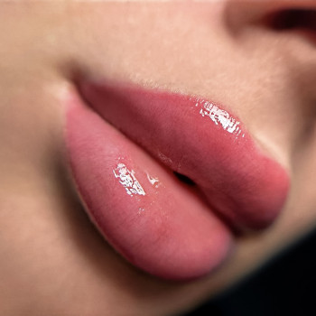 Ліза Яковчук, Вишневе Фото - 10