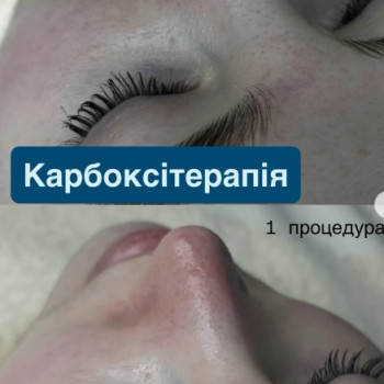 Анна Ротар, Дніпро Фото - 5