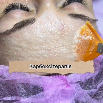 Дарина Буренко, Дніпро Фото - 5