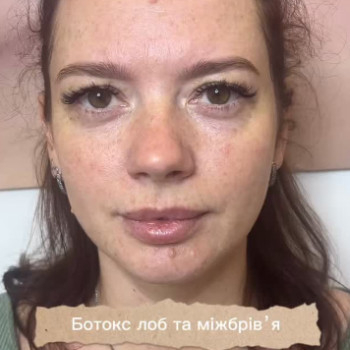 Дарина Буренко, Дніпро Фото - 6