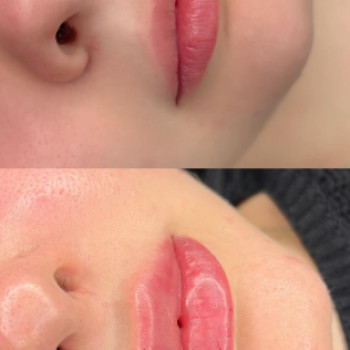 Виктория Дутко, Днепр Фото - 6