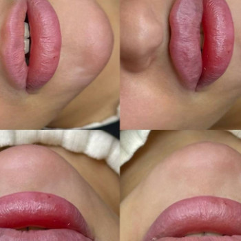 Olivia Lips, Днепр Фото - 5