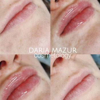 Дар'я Мазур, Дніпро Фото - 5