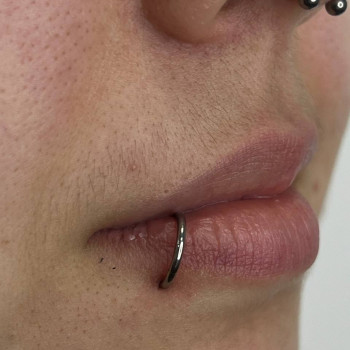 Загоєний прокол губи з титановим кільцем