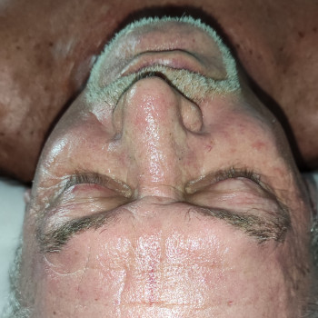 Массаж лица