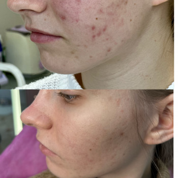 Марія Ткаченко, Киев Фото - 26