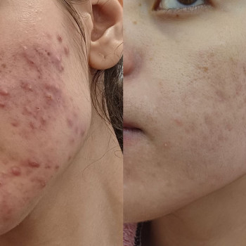 Марія Ткаченко, Киев Фото - 25